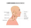 Diagram of Lymph nodes of the head and neck. Royalty Free Stock Photo