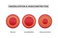 Vasodilation and vasoconstriction. comparison of Blood vessels. Royalty Free Stock Photo