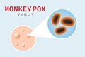 Monkeypox virus on skin. Diagram of a virion cell under a microscope. Royalty Free Stock Photo