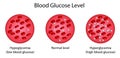 Blood Glucose Levels. normal level, hyperglycemia , hypoglycemia, sugar test. vector diagram