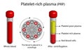 Platelet-rich plasma (prp). Autologous conditioned plasma