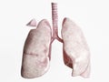 Wedge resection after severe lung disease - 1 of 4 - 3D Rendering