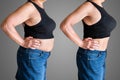 Before And After Weight Loss Liposuction