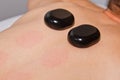 Wellness concept. Handsome young man relaxing under the stimulating effect of a traditional hot stone massage in a luxury spa and Royalty Free Stock Photo