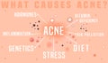 What causes acne poster. Skin disease, dermatology, cosmetology concept.