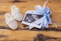 White Baby Boots with Blue Ribbon Bow around Ultrasound Image on Rustic Wooden Surface, Gender Reveal or Pregnancy Announcement Co Royalty Free Stock Photo