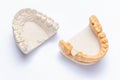 On a white background are plaster models of the jaws with a ceramic crown made on a molar. white artificial tooth on the implant.