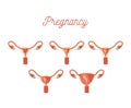 White background silhouette colorful and realistic set pregnancy in female reproductive organ