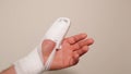 White bandages and a splint on the arm.Broken arm.Bandage and splint on the finger.Bandaged hand.Fractures and sprains