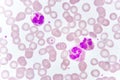 White blood cell in blood smear Royalty Free Stock Photo