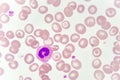 White blood cell in blood smear