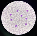 Many lymphocyte on red blood cells background