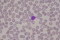 White blood cell lymphocyte on red blood cells background