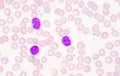 Mature lymphocyte on red blood cells background