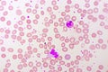 White blood cell in blood smear Royalty Free Stock Photo