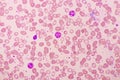 White blood cell in blood smear Royalty Free Stock Photo