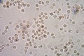 White blood cells of a human, photomicrograph panorama as seen u