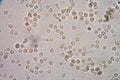 White blood cells of a human, photomicrograph panorama as seen u Royalty Free Stock Photo