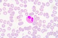 White blood cells of a human, photomicrograph panorama as seen u