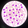 White blood cells on red blood cells background