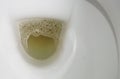 White ceramic toilet bowl full of urine, close-up shot