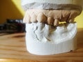 White dental teeth model from the dentist Royalty Free Stock Photo