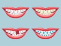 White, dirty, decayed, broken and orthodontics tooth