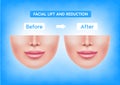 White female face before after plastic surgery jaw reduction and botox injections facial lift and reduction. Royalty Free Stock Photo