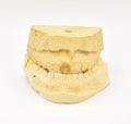 Dental Molds on White Background Royalty Free Stock Photo