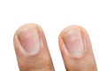White spots on fingernails Royalty Free Stock Photo