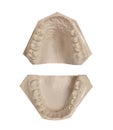 White stone models of teeth