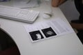 On a white table in the doctor's office are the results of an ultrasound scan. The doctor conducts a consultation of Royalty Free Stock Photo