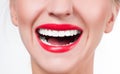 White teeth and red lips. Perfect female smile after whitening teeth. Royalty Free Stock Photo