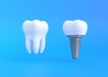 White tooth and dental implant on a blue background Royalty Free Stock Photo