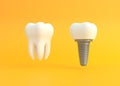 White tooth and dental implant on a yellow background Royalty Free Stock Photo