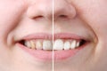 Whitening or bleaching treatment ,before and after ,woman teeth and smile, close up, isolated on white Royalty Free Stock Photo