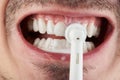 Whitening teeth theme Royalty Free Stock Photo