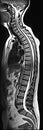 WHOLE SPINE MRI Royalty Free Stock Photo