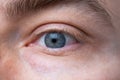 Wide open Caucasian male eye. Close up shot portrait, unrecognizable face Royalty Free Stock Photo