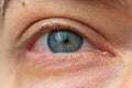 Wide open Caucasian male eye. Close up shot portrait, unrecognizable face