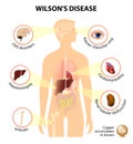 Wilson's disease