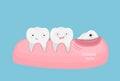 Wisdom teeth illustration. Royalty Free Stock Photo