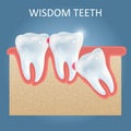 Wisdom teeth problems vector poster design template
