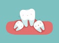 Wisdom tooth make tooth lose balance, dental healthy concept