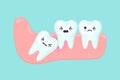 Wisdom tooth problems dental stomatology vector concept Royalty Free Stock Photo