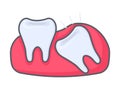 Wisdom tooth pushing another tooth, teeth and dentistry tooth concept in flat style isolated on white background. Vector