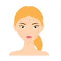 Woman with acne skin problem face. Vector illustration