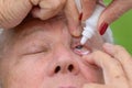 Woman administering eyedrops to an elderly man