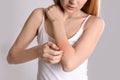 Woman with allergy symptoms scratching forearm on grey background Royalty Free Stock Photo
