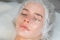 Woman with anesthesia cream and film on her face before PRP therapy procedure.